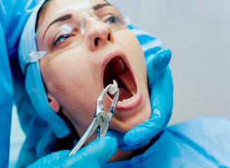 Tooth Removal